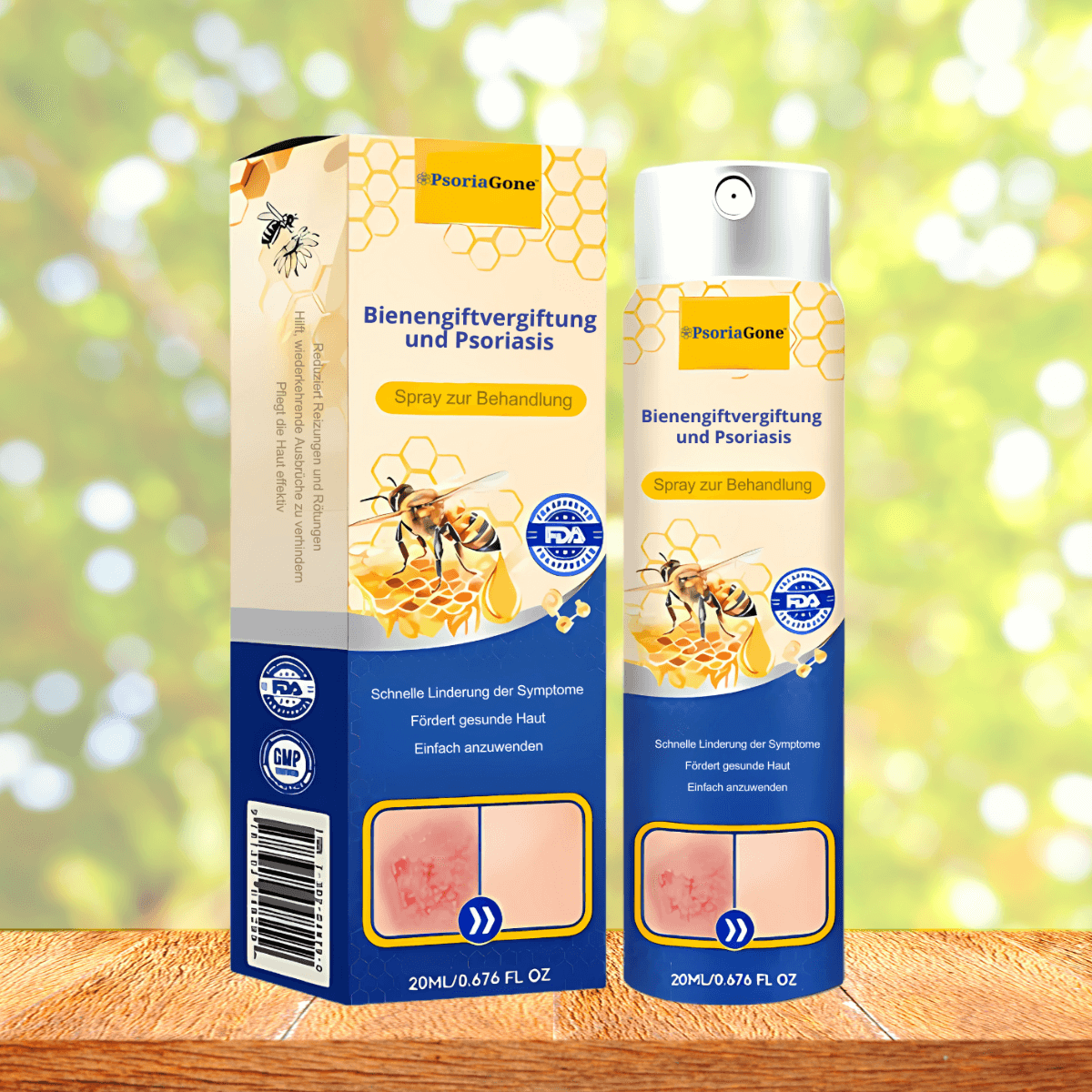 PsoriaGone CH